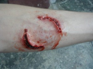 Юргинец искусал полицейского